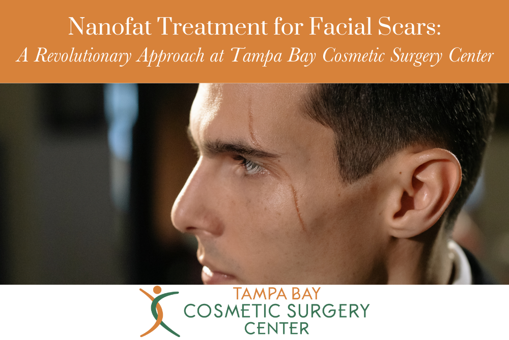 Nanofat Treatment for Facial Scars A Revolutionary Approach at Tampa Bay Cosmetic Surgery Center