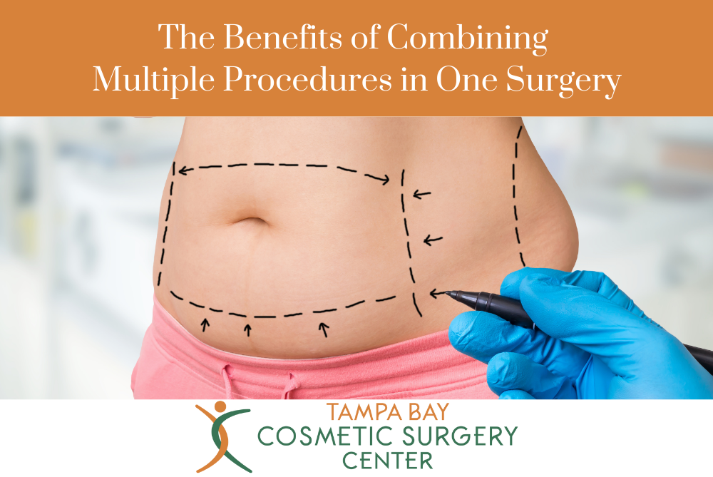 The Benefits of Combining Multiple Procedures in One Surgery