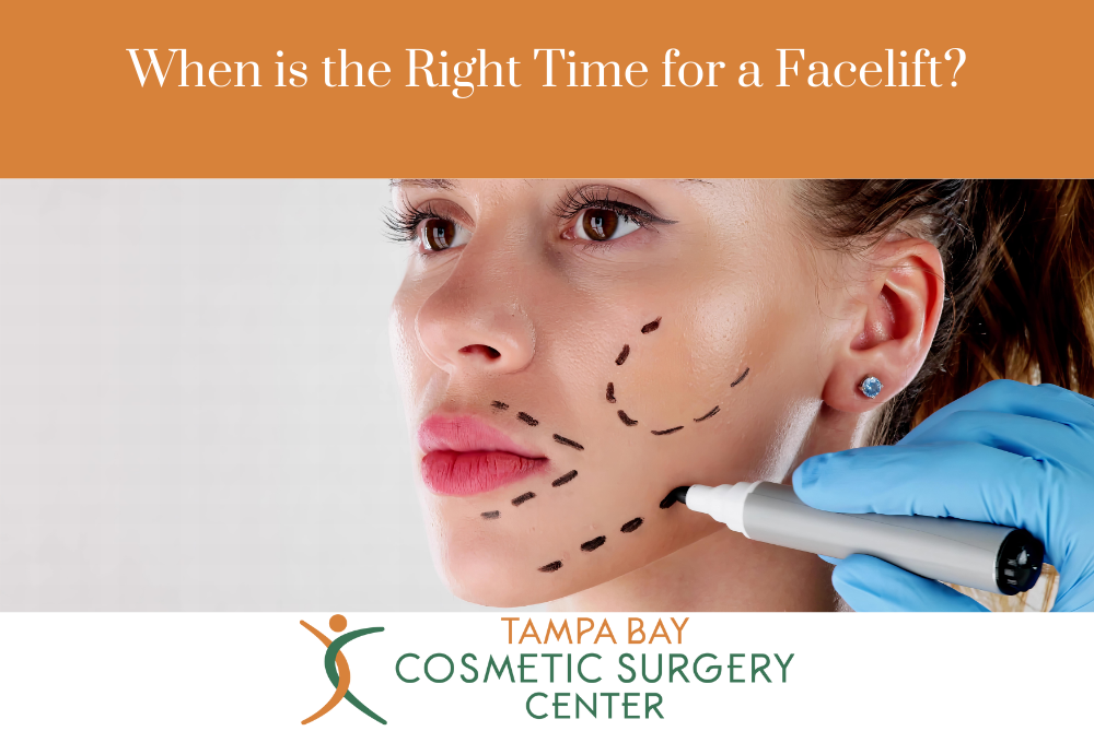 When is the Right Time for a Facelift