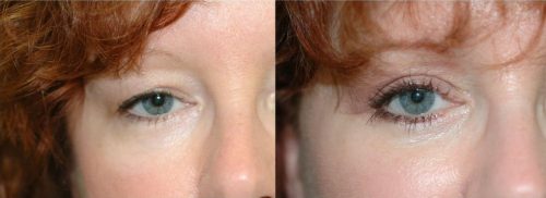 Green Red Before After YouTube Thumbnail - 1